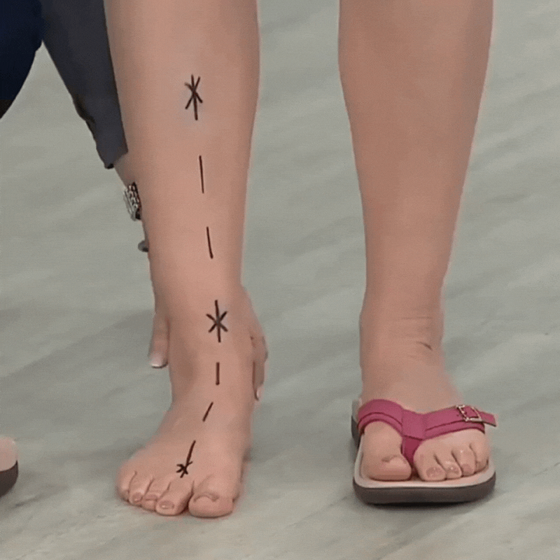 Pylera™ | Orthopedic Summer Sandals